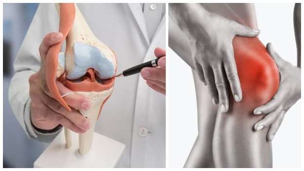 Menisküs Yırtığı Nedir? Nasıl Tedavi Edilir?