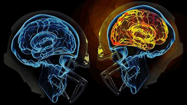 Hafif Darbeler Bile ‘Beyin Hasarı’ Yaşatabilir!