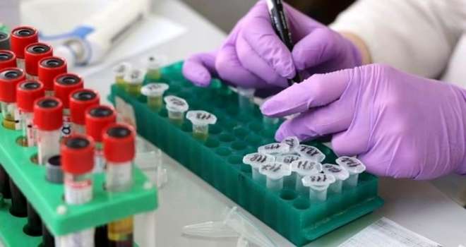 Hct Nedir? Hct Düşüklüğü Ve Yüksekliği Nedenleri