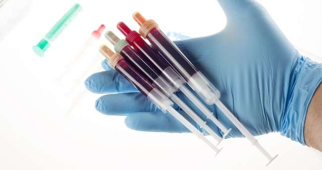 PDW Nedir? PDW Nedir Kan Tahlili