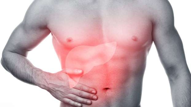 Siroz Nedir? Belirtileri Nelerdir? Tedavisi Var Mıdır?