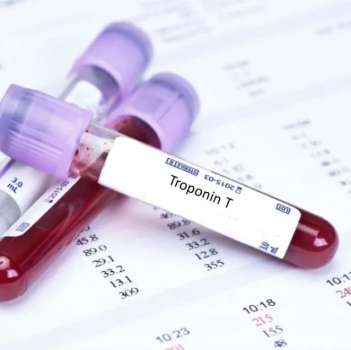 Troponin Nedir? Troponin Yüksekliği Ve Düşüklüğü Nedenleri…