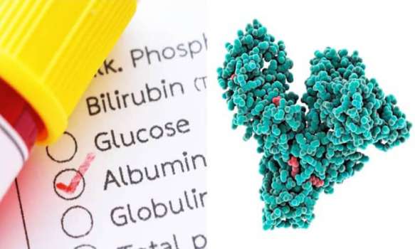 Albumin Nedir? Albumin Yüksekliği Ve Düşüklüğü Nedenleri