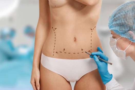 Liposuction (Liposakşın) Nedir? Kimlere Uygulanabilir?  2023 Liposakşın Fiyatları…