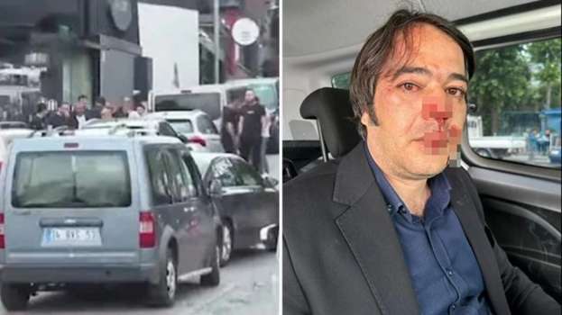 Üsküdar’da Kaçak Kafe Yıkımında Kavga! İmar Müdürünü Dövdüler..