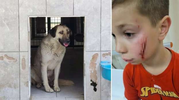 Tatil İçin Türkiye'ye Gelen Küçük Çocuğa Sokak Köpeği Saldırdı