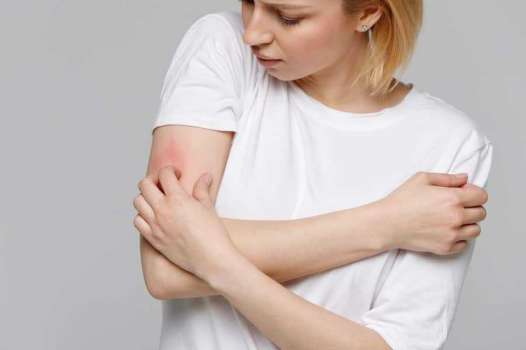 Vücutta Kaşıntı Neden Olur? Kaşıntıya Ne İyi Gelir?