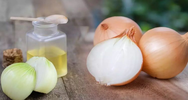 Fermente Soğan Suyu-Biberiye Yağı: Saç Dökülmesi Doğal Çözümü